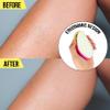 Crystal Hair Remover - 1pc Crystal Hair Eraser, Razorless Shaver Hair Removal Device | Pain-Free Hair Removal & Exfoliation Tool view 4