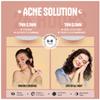 GoGleefy Pimple Patches for Face  Day & Night Acne Patches for Fast Healing, Skin Clarity  Invisible Hydrocolloid Patches, Waterproof Spot Treatment  All Skin Types Zit Patches of 60/120/180 view 4