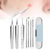 2025 Medical Grade Blackhead Extraction Tool Kit, Professional Facial Blackhead Remover Tweezers, Grade Extractor Tool for Removal Black Heads, Whiteheads, Pimples, Blemishes and Pimples view 1