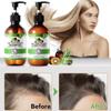 3-in-1 Hair Growth Shampoo & Conditioner Set  10.56 FL OZ | Infused with Rosemary, Black Castor Oil, Batana Oil & Biotin | 2-Piece for Stronger, Thicker Hair view 3