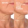 Dr. Brandt Needles No More Neck Tightening Cream - Lifts, Tightens & Reduces Skin Sagginess - Includes a Rose Quartz Gua Sha Tool - 1.7 oz, Pack of 2 view 3