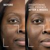 Dr. Brandt Dr. B Lab Brightening Peel Essence - Evens Skin Tone, Smooths Skin Texture & Improves Radiance - 3.4 fl oz, Pack of 2 view 4