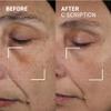 Dr. Brandt Bright This Way C Scription - Concentrated Vitamin C Serum - Fade Dark Spots, Reduce Wrinkles & Illuminate Skin Tone - 1 fl oz, Pack of 2 view 3