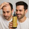 Anti Hair Loss Fortified Hair Tonic with Placenta, Amniotic Fluid, Professional Use, 10 Fl Oz. Tnico Capilar Fortificado con Placenta, Lquido Amnitico, Uso Profesional, 10 Fl Oz view 2