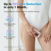 Oreeth Laser Hair Removal Device, at-Home IPL Hair Removal for Women & Men - Safe 45F Ice-Cooling Contact for Painless & Long-Lasting Results, 86% Hair Reduction in 3 Weeks for Full Body, Gold/White view 4