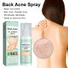 ARCHIDATE Back Acne Spray, Body Acne Spray for Back & Body with Herbal Formula, 2% Salicylic and Tea Tree Oil, Oil Control, Soothes Skin, Back Acne Solution for Women and Men, 120ml view 2