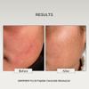 The Formularx Peptide Ceramide Moisturizer - Barrier Plus Nourishing Barrier Repair Moisturizer For Normal, Dry, Compromised, Sensitive skin 50 g view 4
