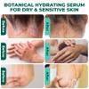 ABERA Alan Silver Serum  Gentle Botanical Formula for Dry, Flaky Scalp and Sensitive Skin  Enhances Skin Comfort and Moisture Balance  Lightweight, Non-Greasy Texture  Bonus Gift Included view 3