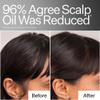 Act+ Acre, 4% Niacinamide Serum, Oily Scalp Control, 2.2 fl oz view 3