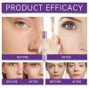 Blemish Concealer Stick - Pimple Concealing Rod, Scar Disguising Pen | Dark spat Minimizing Applicator, Redness Neutralizing Marker, Under Eye Shadow Blending Stick, Travel Size Skin Cover Concealer view 3