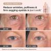 Extreme Cream Eye Firming & Contouring Refillable Eye Cream -Size:(0.5oz / 15ml) view 4