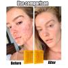 3PCS Lemon Turmeric Kojic Soap + 3 Bubble Nets | Organic Face & Body Bar | Cleansing & Exfoliating | All Skin Types view 4