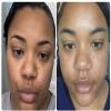 Turmeric Face & Body Scrub - (Citrus & Chamomile) Deep Cleansing, Exfoliating, Natural Oils view 2