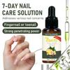 2PCS Ginger Nail Serum Solution, Ginger Cuticle Care Oil for Nails view 2