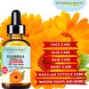 Botanical Beauty CALENDULA HERBAL OIL Calendula Officinalis Marigold Oil 100% Natural for FACE, SKIN, BODY, HAIR, NAILS, Foot Care. 1 Fl.oz.- 30 ml view 3