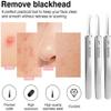 3 Pcs Silver Professional Blackhead Tweezer Professional Facial Blackhead Remover Tweezers Precision Extractor Acne Removal Kit Pimple Popper Tools view 4