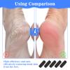5 Pcs Extra Coarse Replacement Refill Heads, Foot Scraper Rollers for Calluses and Heels for Amope Pedi Refills Electronic Foot File, Leaving Feet Soft and Smooth view 3