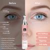 Eye Serum For Dark Circles, 8% Caffeine 8% Retinol Eye Cream Anti Aging With 360 Massage Ball For Puffiness, Under Bags And Fine Lines(2 PCS) view 4