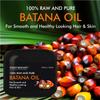 100% Natural Raw Batana Oil promoting Hair Growth, Dr. Sebi Hair Oil from Honduras, Prevent Hair Loss, Eliminates Split Ends for Men & Women 4 fl oz view 2