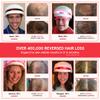 Hair Strength & Regrowth Pack: Essential Hair Device + Max Growth Essentials view 4
