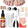 Ingrown Toenail Removal Kit, Professional Ingrown Toenail Treatment, Ingrown Toenail Tools Kit with Ingrown Toenail Corrector Drops, Toenail Clipper, Corrector Patch, Stainless Steel Pedicure Tool Set view 1
