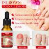 Ingrown Toenail Removal Kit, Professional Ingrown Toenail Treatment, Ingrown Toenail Tools Kit with Ingrown Toenail Corrector Drops, Toenail Clipper, Corrector Patch, Stainless Steel Pedicure Tool Set view 3