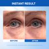 Instant Under Eye Lift Serum - Reduces Eye Bags, Wrinkles, Puffy Eyes, Dark Circles & Crows Feet in Minutes - Advanced Firming Polysaccharide Formula for Mature Skin - 20 mL view 3