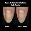 ProStrong BioFusion Nail Grafting Serum view 2