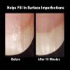 ProStrong BioFusion Nail Grafting Serum view 3