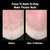 ProStrong BioFusion Nail Grafting Serum view 4