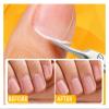 1Pcs Cuticle Scissors Nipper Dead Skin Scissors Stainless Steel Manicure Pedicure Tools Portable Exfoliating Nail Trimmer(MULTI) view 2