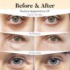 BLOOMORA Vitamin C & Caffeine Under Eye Patches (30 Pairs), Under Eye Mask for Puffy Eyes, Appearance of Dark Circles, Smoothing & Hydration, Self Care & Skincare Gifts for Women, Patch Yeux view 4