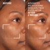Dr. Brandt Advanced Microdermabrasion Face Exfoliator - Refines Texture, Minimizes the Look of Fine Lines & Enhances Overall Skin Tone - 2 oz view 2
