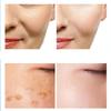377  Anti-Wrinkle Cream, 377 Corrector Face Cream, Hydrate & Moisturize (3PCS) view 2