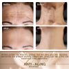 Stasover Neck Wrinkle Patches  Reusable Silicone Pads for Neck & Forehead, Anti Wrinkles Silicone Patches for Frown Lines, Smooth & Hydrating Overnight Skincare Pads for Women, 6 Pcs Set view 4