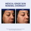 Obagi Medical Retinol + PHA Refining Night Cream - Clinically Proven, Dual-Action, Overnight Anti-Aging Face Cream for Smoother, Renewed Skin & a More Even-Looking Complexion - 1.7 Oz view 4
