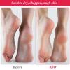 3 Pairs Foot Moisturiser Socks Overnight, Spa Cotton Socks for Foot Cream, Lotion Sock for Moisturising for Dry Feet Care, Moisturising Sock for Cracked Heel Repair Women Men (White) view 3