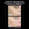 Allies of Skin Tranexamic & Arbutin Advanced Brightening Serum view 3