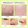Lemon Exfoliating Gel for Face & Body, Gentle Peeling Gel Deep Cleansing Blackhead Pore Minimizer Facial Exfoliator, Moisturizing, Refreshing Oil Control Softer Skin 60ml view 3