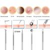 8 PCS Stainless Steel Blackhead Remover Kit,Acssart Stainless Steel Blackhead Remover,Pimple Popper Tool Kit,Pimple Extractor,Pore Cleaner Tool,Gentle and Easy to Clean (Black) view 3