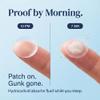 SKINSENPAI Pimple Patches, 120 Count view 3