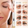 Eye Gel with Plant Stem Cells & Peptide Complex for Under & Around Eyes  Reduces Puffiness, Dark Circles & Fine Lines  With Matrixyl 3000 & Arginine for a Smoother, Refreshed Look for Men & Women. view 4