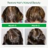 Hipertin Hair Serum Scalp Care for Men & Women 50 ml view 3