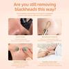 FAFUBOTIF 1 Pcs Blackhead Remover Tools, Silicone Face Scraper for Deep Cleansing, Nose Blackhead Remover for Women Men - Heart-Shaped - Beige view 3
