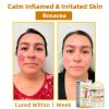 AEEHFENG Bee Venom Skin Repair Cream, Advanced Bee Venom Firming Serum Stick, Firming & Wrinkle-Reducing Cream, Hydrating, Natural Ingredients Suitable for All Skin Types (3 Bottle) view 2