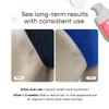 Bushbalm Ingrown Hair 2 Step Routine - Moisturize and Soothe - Ingrown Hair Oil (30 ml), Exfoliating Scrub (236 ml) - Watermelon Sugar - Valued at $49 view 2