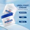 OUKEYA Urea Cream,NEW FORMULA Urea Cream 40 percent for Feet Maximum Strength,Dry Cracked Treatment Lotion for Knees & Elbows,Foot Dead Skin Cuticle Callus Remover Toenail Softener,5.29 oz2 Packs view 3
