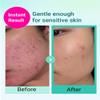 BRING GREEN TEA TREE CICA TRIAL KIT | Travel Size Korean Skin Care Set for Acne-Prone, Sensitive Skin | Zinc Teca Serum, Tea Tree Cica Moisturizer & Deep Cleansing Foam | Hydrating & Oil Control view 4