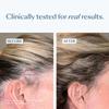 eSalon Soothing Scalp Serum with Biotin and Copper Tripeptide, Antioxidant-Rich Formula, 1 fl oz view 4