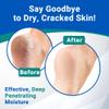 Dermal Therapy Heel Care Liquid Roll-On  Intensive Moisturizing & Repair for Cracked Heels, Dry & Rough Skin  Fast-Absorbing, Mess-Free Application  Hydrating Foot Care Treatment view 4